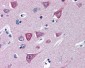 SOCS1 Antibody (N-Terminus)
